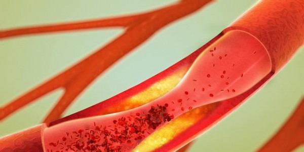 医生：高血压患者，宁可每天慢走30分钟，也别碰这5件伤血管的事