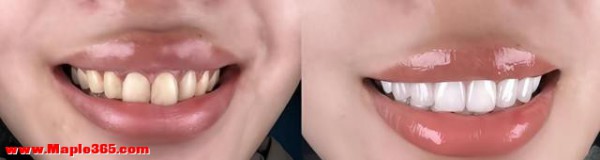 2026牙膏实测TOP10！花植曼色修美白祛黄不踩雷