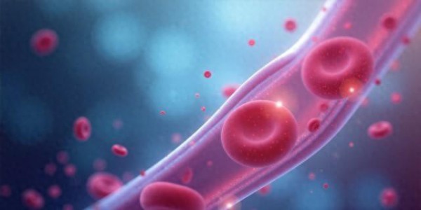 不胖还运动，却长颈动脉斑块？降胆固醇关键在这2步，才不长斑块