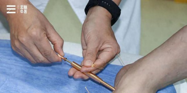 针灸到底科不科学？从中医视角读懂千年智慧的科学内核