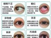 泪目危机！眼睛干涩畏光、寒风一吹就流泪的根源与自救指南