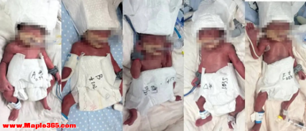 罕见五胞胎全保住，20多名医护深夜齐上阵