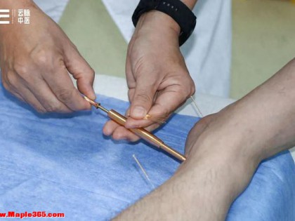 针灸到底科不科学？从中医视角读懂千年智慧的科学内核