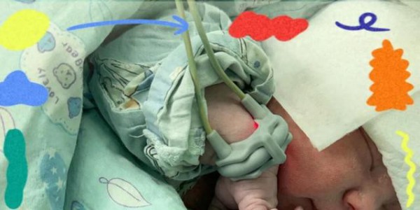 海宁一位妈妈生下“天选女宝”！医生：太罕见了！