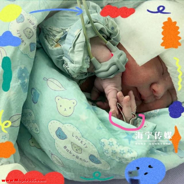 海宁一位妈妈生下“天选女宝”！医生：太罕见了！