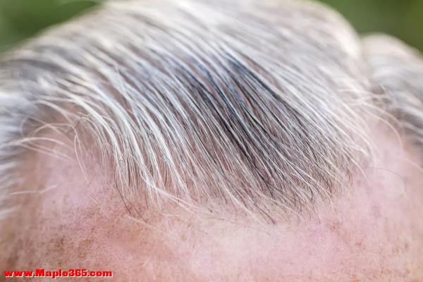 白发长在不同地方、突然增多是老了吗？可能是身体发出的预警信号-2.jpg