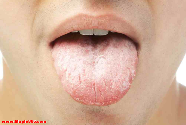 刷牙时要“刷舌头”吗？提醒：或许是搞错了，口臭才会一直存在-5.jpg